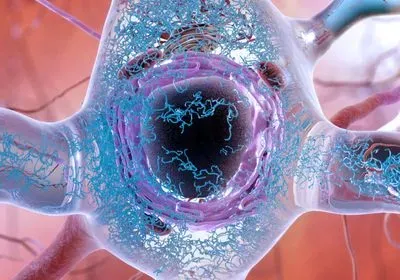 artistic drawing of neuron filled with tau proteins